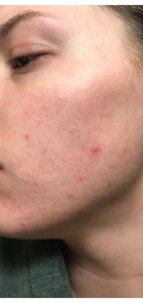 After image