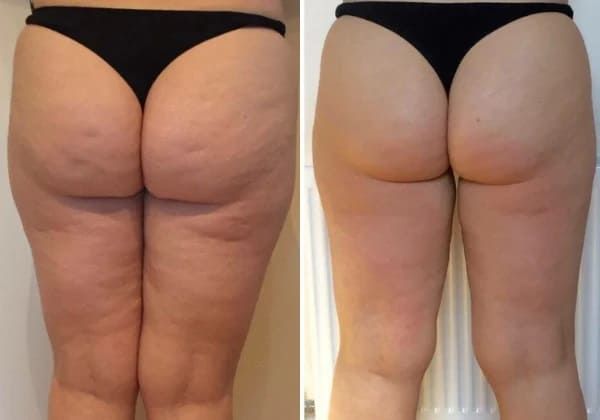 Sophie L. - Photo du produit reçu